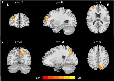 Learning to read Chinese promotes two cortico-subcortical pathways: The development of thalamo-occipital and fronto-striatal circuits